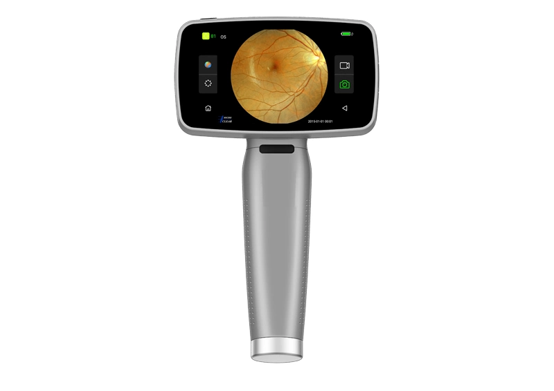 Mslha07 Touch Screen Portable Eye Fundus Camera Price