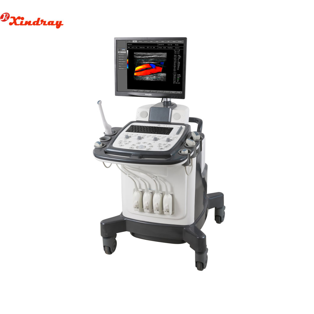 High Quality Manufacturer Price Medical Diagnosis Equipment Portable Laptop Ultrasound Machine