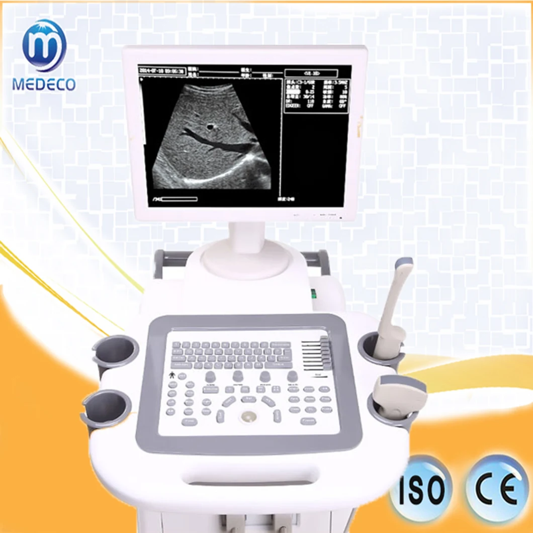 Hospitals High Quality Abdominal Therapy Use Me 3018II Full Digital Trolley Ultrasound Scanner