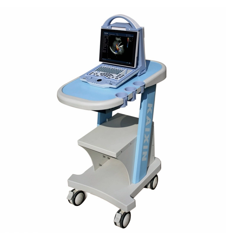 Clinical Laptop Color Doppler Ultrasound Machine Price 4D Ultrasound Scanning High Frame Frequency, High Density