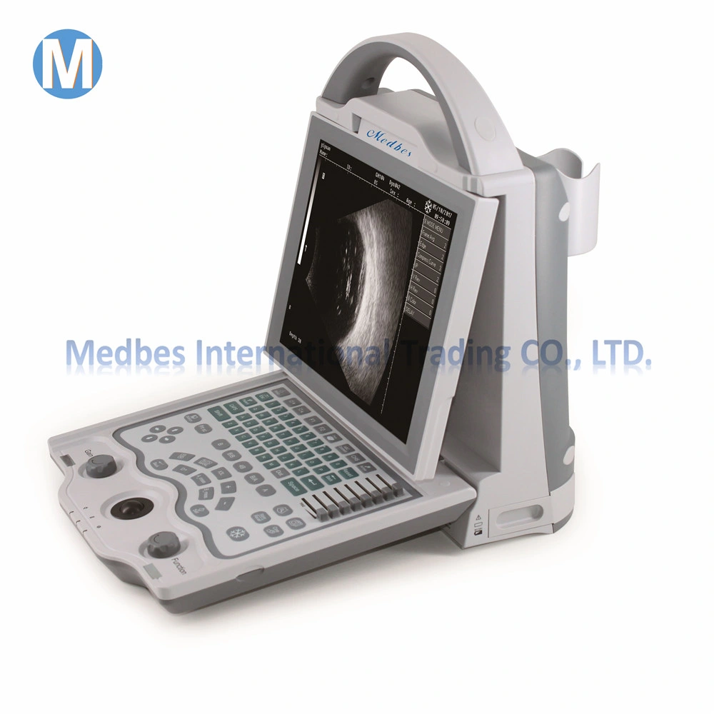 Ophthalmic Equipment Ophthalmic a/B Ultrasound Scanner