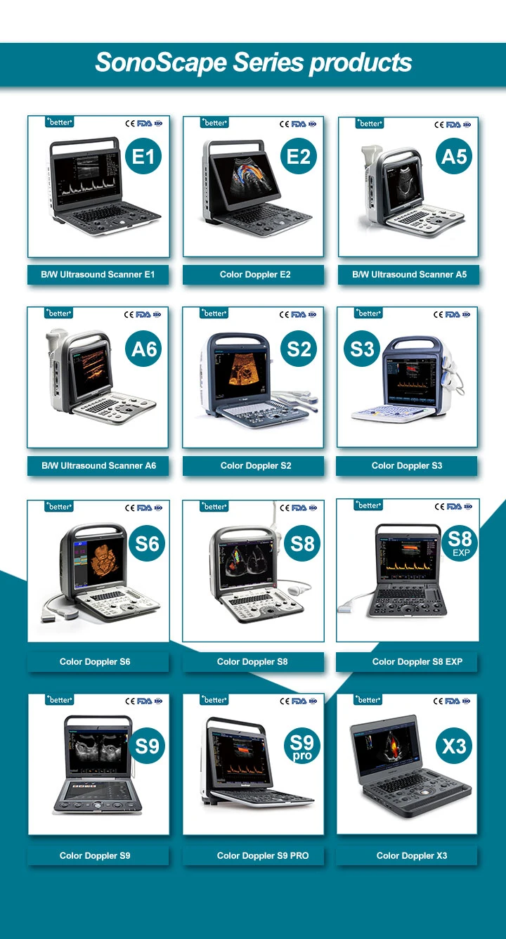 High Quality Ultrasound Machine Price Testing Machine