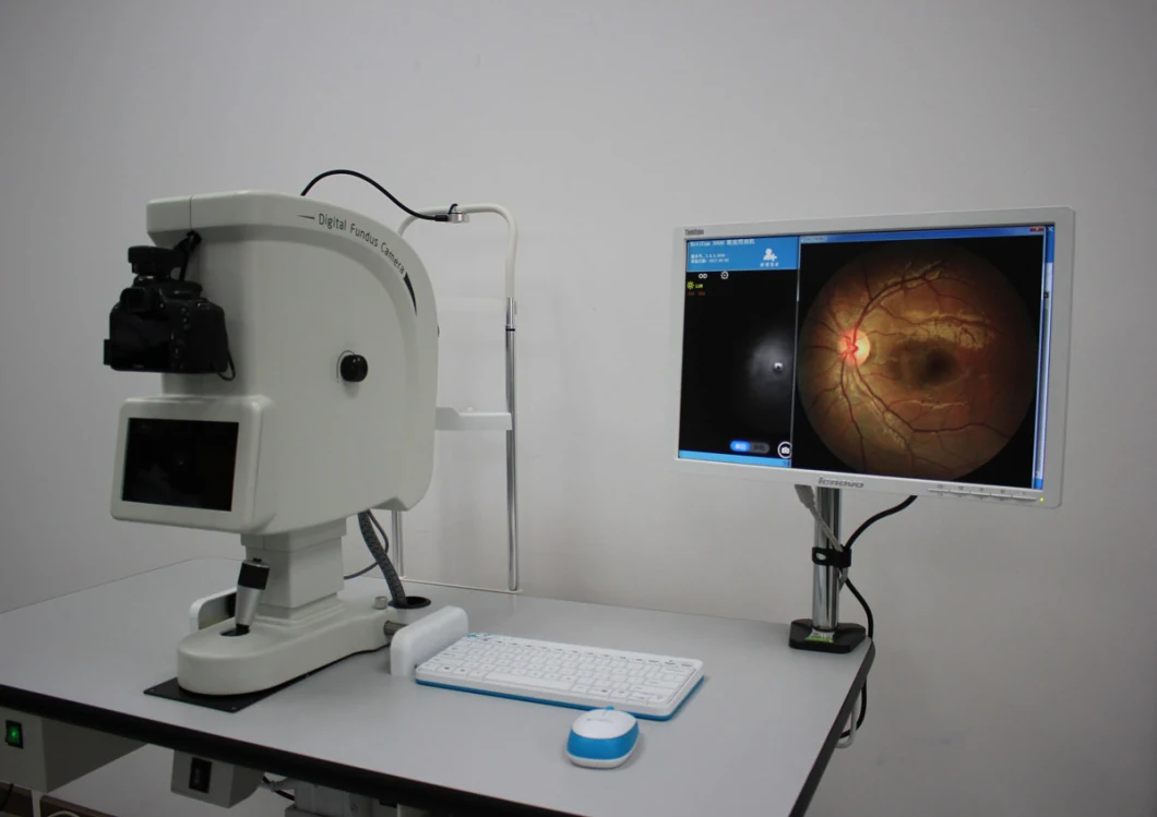 High-Definition Non-Mydriatic Automatic Fundus Camera Ophthalmic Optical Equipment Mslafc04