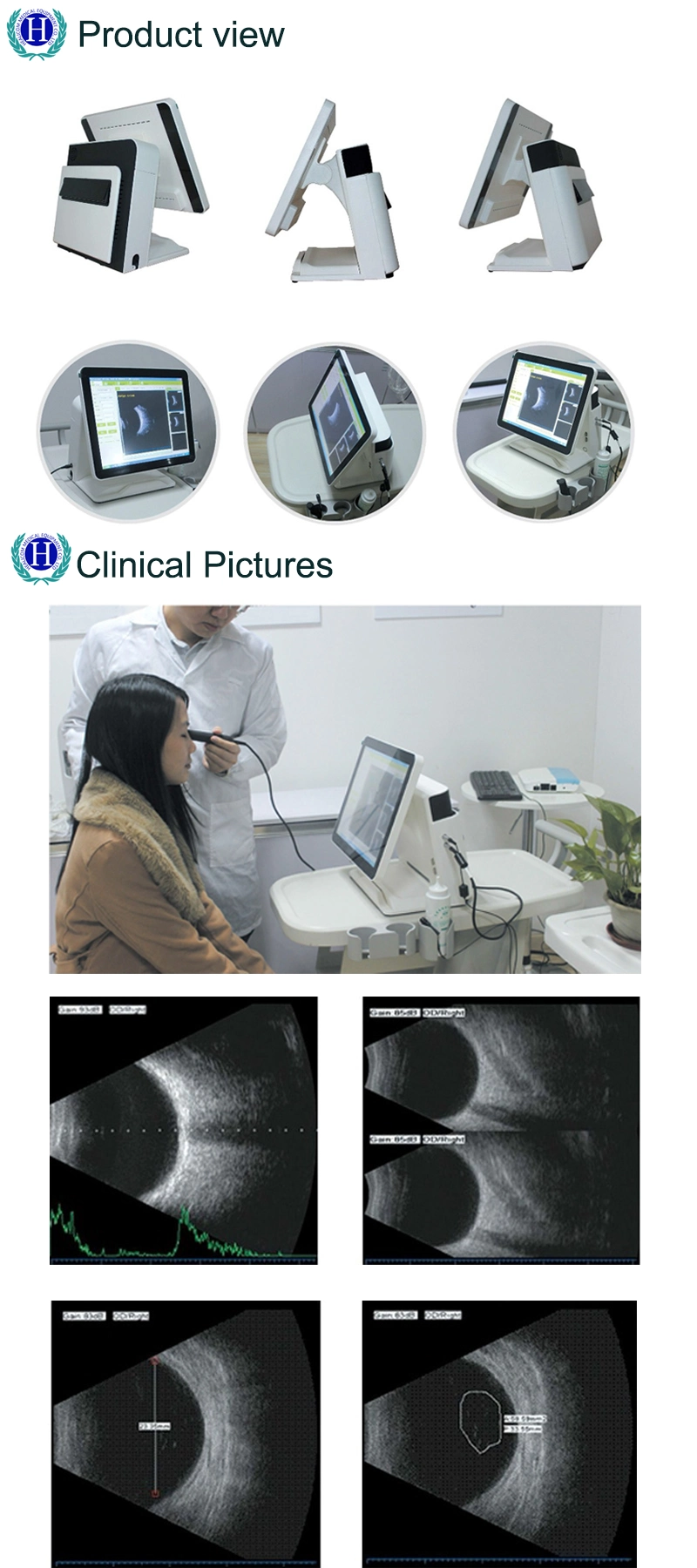 Medical Eye Equipment Ophthalmic Ultrasound System Machine a/B Scanner Biometer