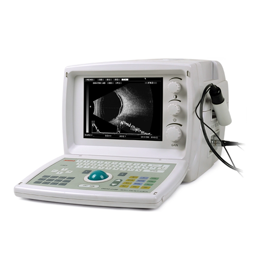 High Quality Economic Ultrasound a/B Scan for Ophthalmology (ODM-2100S)