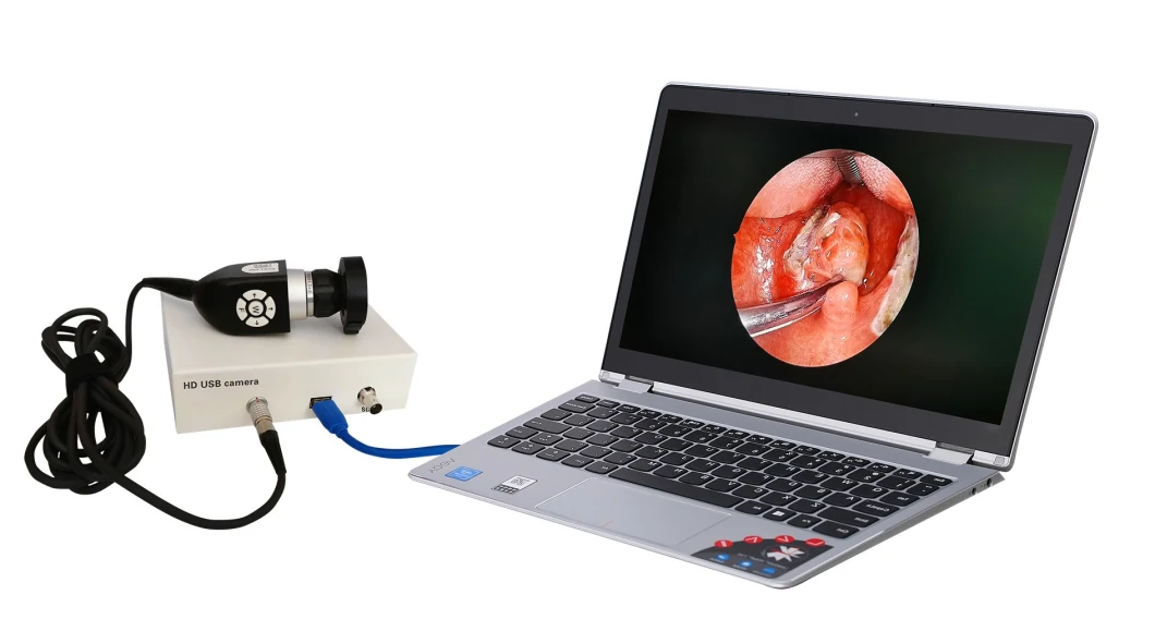 HD-7021 Medical Portable Camera System Endoscopy Camera with LED Cold Light Source for Hospital
