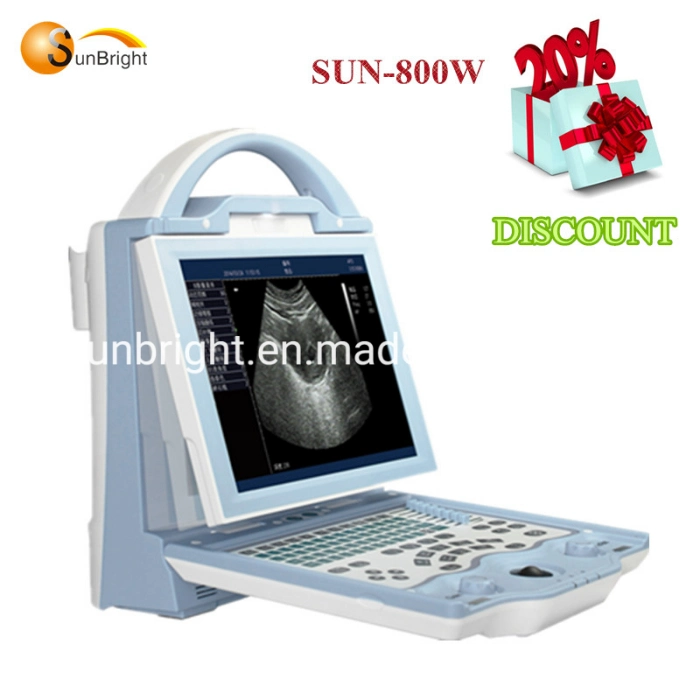 Discounted Portable Cheapest 2D Ob/Gyn Ultrasound Scanner with High Quality