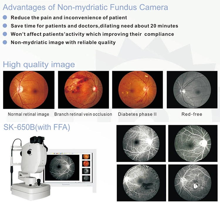 Ophthalmic Equipment Digital Eye Fundus Camera & Ffa Sk-650b
