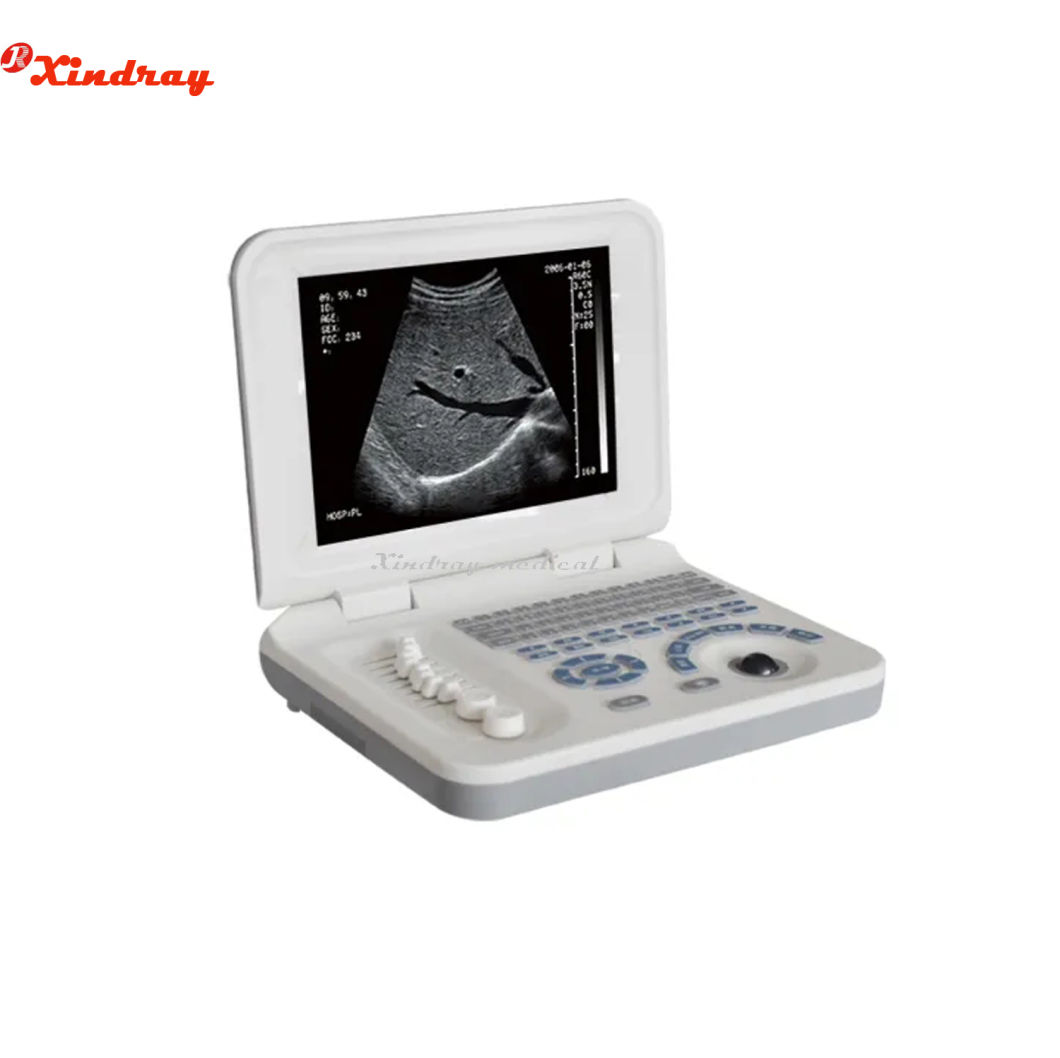 High Quality Manufacturer Price Medical Diagnosis Equipment Portable Laptop Ultrasound Machine
