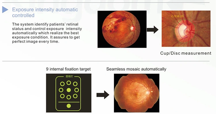 Ophthalmic Equipment Digital Eye Fundus Camera & Ffa Sk-650b