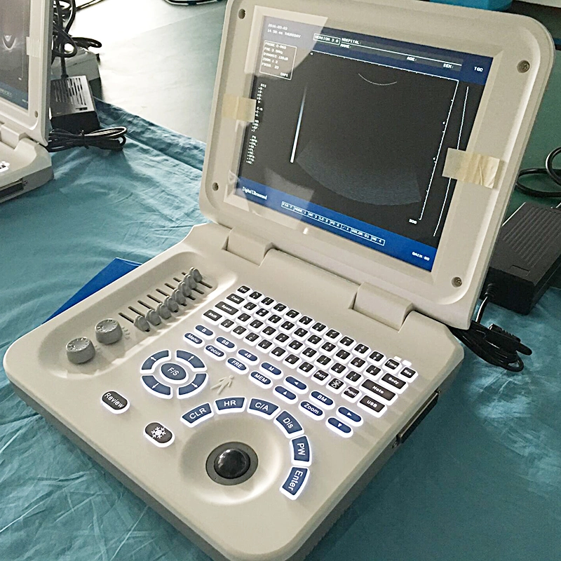 Hc-A006 China High Quality LED Hospital Machine Ultrasound Equipment Laptop Full Digital Ultrasound Scanner System