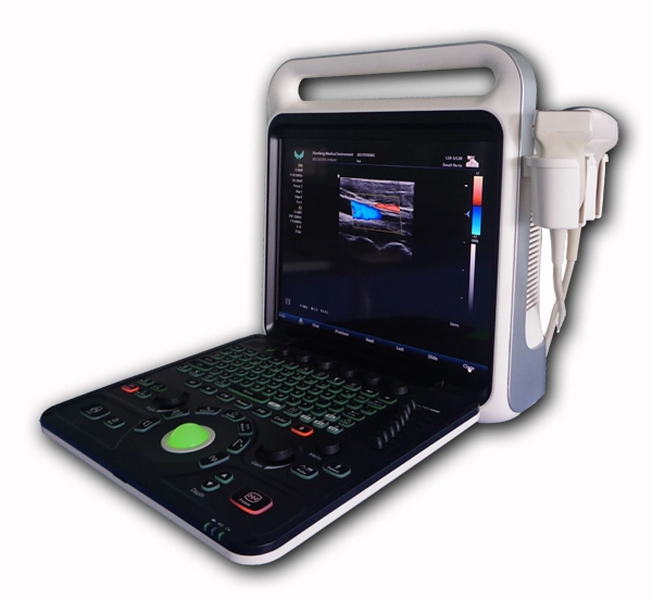 Color Doppler Ultrasound Scanner/ Full Digital Diagnostic Ultrasound Machine Echo Phased Probe E80 Xf3800
