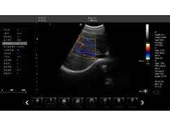 China Supplier Cardiac Ultrasound Machine Trolley Color Doppler Ultrasound Scanner