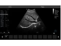 China Supplier Medical Device Ultrasound Color Doppler Ultrasound Scanner