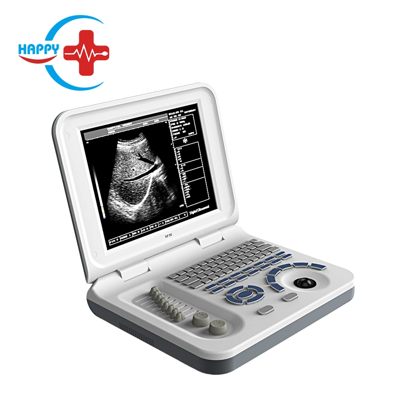 Hc-A006 China High Quality LED Hospital Machine Ultrasound Equipment Laptop Full Digital Ultrasound Scanner System