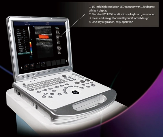 High Quality Portable 4D Baby Fetal Color Doppler Ultrasound Scanner