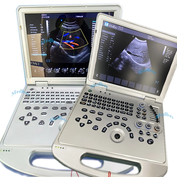 Dawei Ultrasound Diagnostic 4D Portable Ultrasound Scanner Dw-L5 Ecography