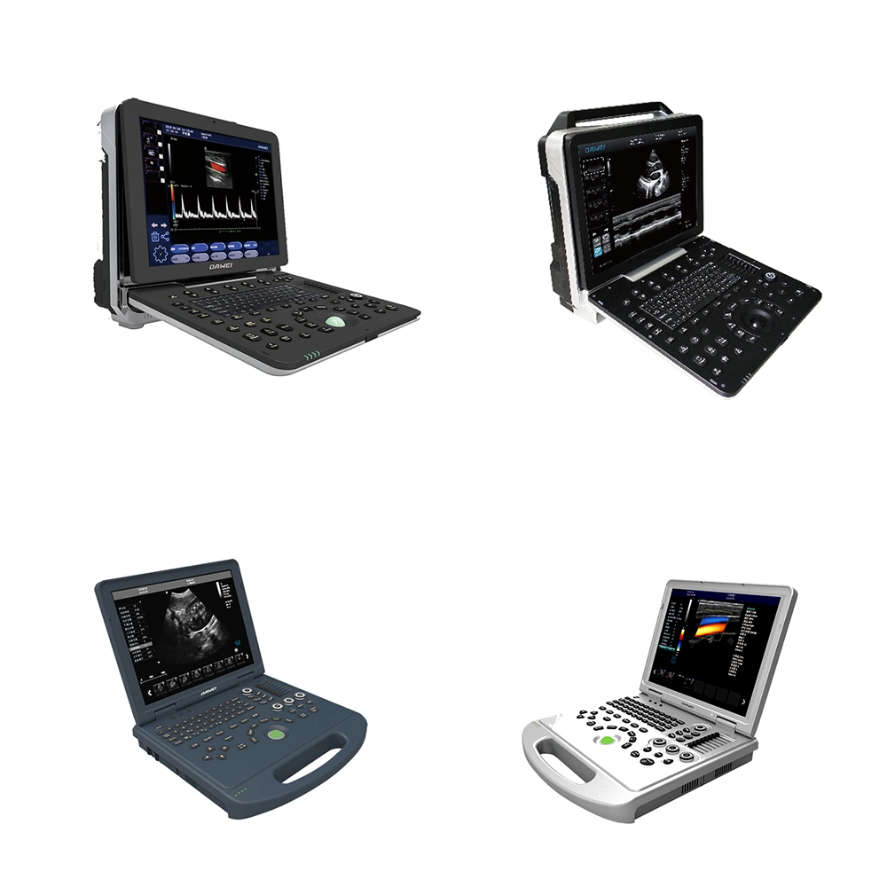 China Supplier Medical Device Ultrasound Portable Ultrasound Scanner