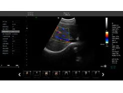 China Supplier Medical Device Ultrasound Color Doppler Ultrasound Scanner