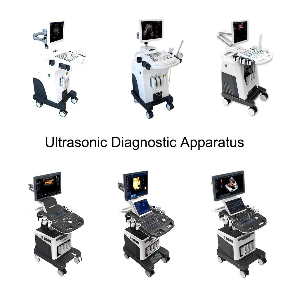 China Suppiers Ultrasound Diagnosis System Color Doppler Ultrasound Scanner