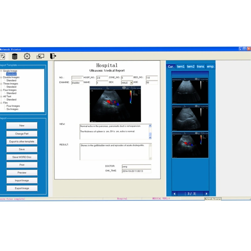 Clinical Laptop Color Doppler Ultrasound Machine Price 4D Ultrasound Scanning High Frame Frequency, High Density