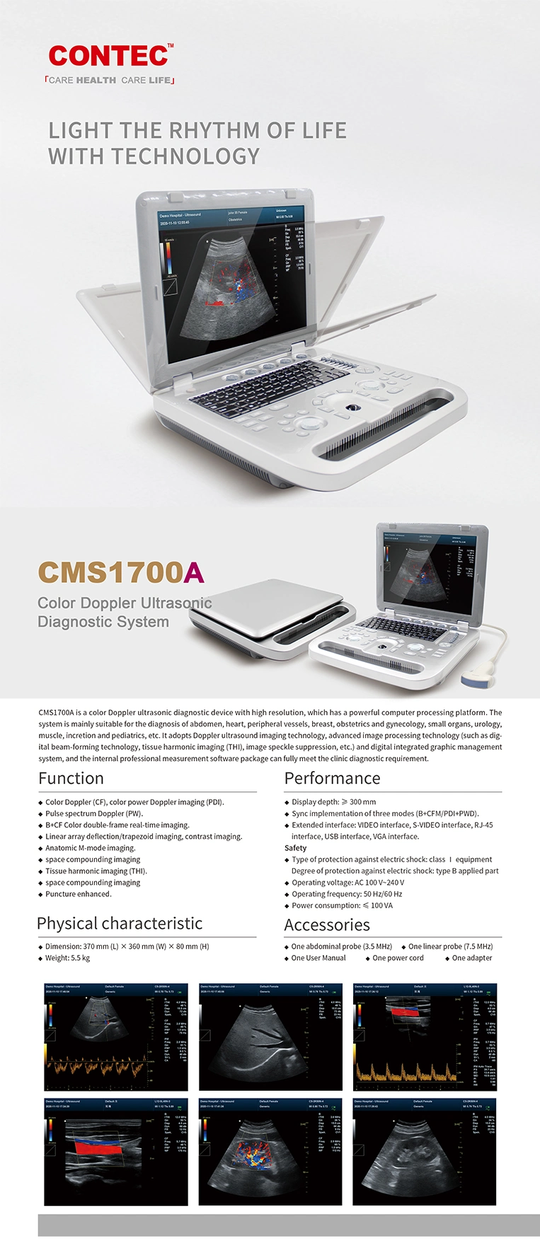 Contec Factory Portable Ultrasound Machine Ultrasound System Color Doppler Ultrasonic Diagnostic Device