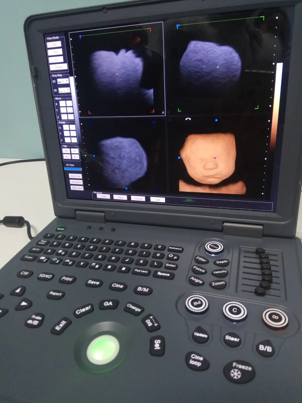 Cheap Portable Color Doppler Ultrasound Machine Diagnostic System Anesthesia Cardiac Ultrasound
