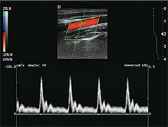 China Top Cardiac Ultrasound Machine Trolley Color Doppler Ultrasound Scanner