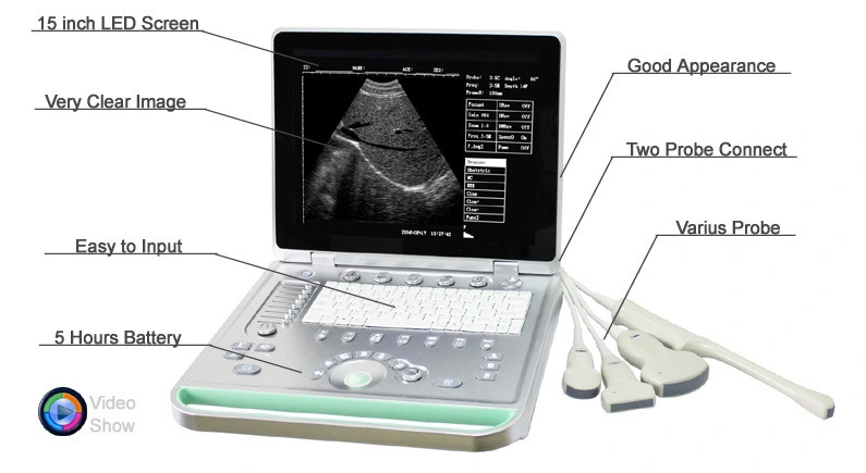 Hv-7 Fill Digital B Mode Portable Laptop Medical Veterinary Ultrasound Scanner Diagnostic Vet Ultrasound Machine