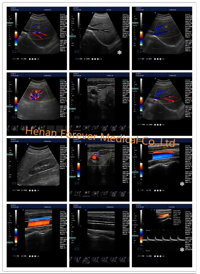 High Quality Portable 4D Baby Fetal Color Doppler Ultrasound Scanner