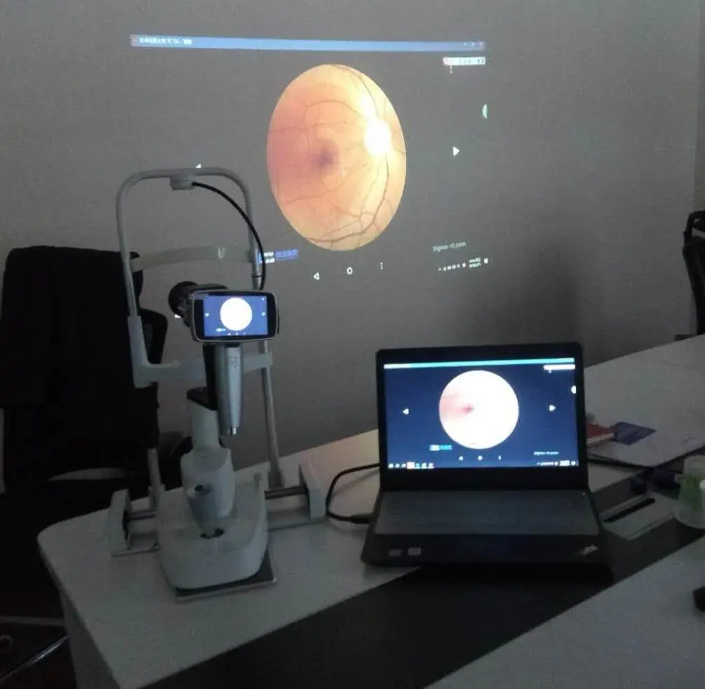Mslha07 Touch Screen Portable Eye Fundus Camera Price