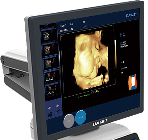 China Cardiac Ultrasound Machine Trolley Color Doppler Ultrasound Scanner
