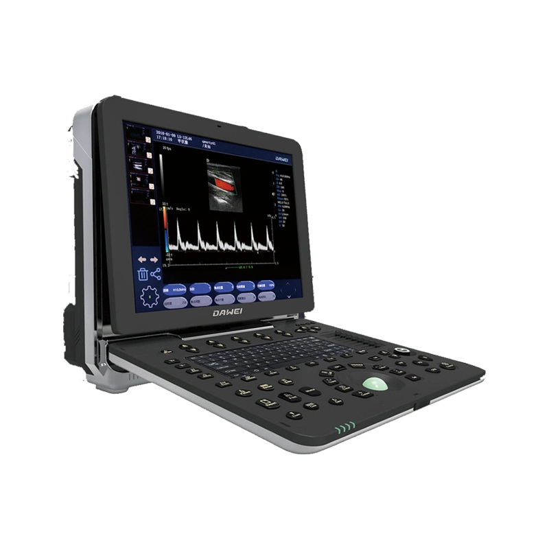 China Top Cardiac Ultrasound Machine Trolley Color Doppler Ultrasound Scanner