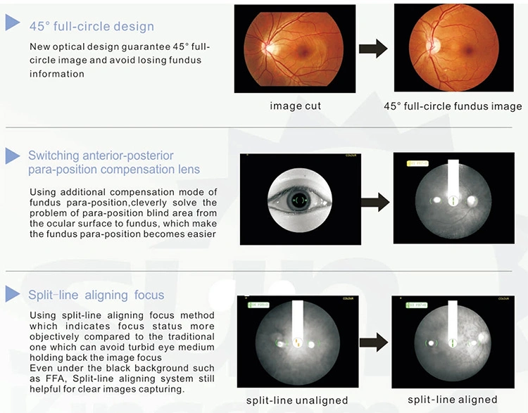 Ophthalmic Equipment Digital Eye Fundus Camera & Ffa Sk-650b