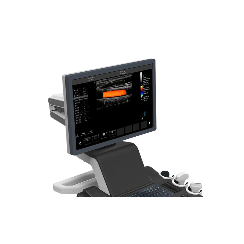 China Supplier Ultrasound Diagnostic Instrument Color Doppler Ultrasound Scanner
