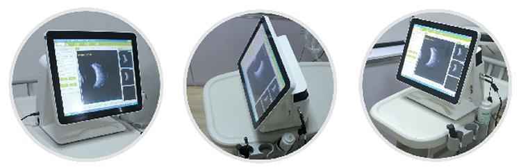 15 Inch LCD Display Ab Scan Ophthalmic Ultrasound