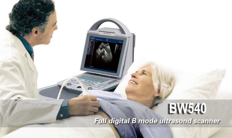 Bw540, Digital Ultrasound Scan Machine, Portable Ultrasound Scanner, Diagnostic Ultrasound