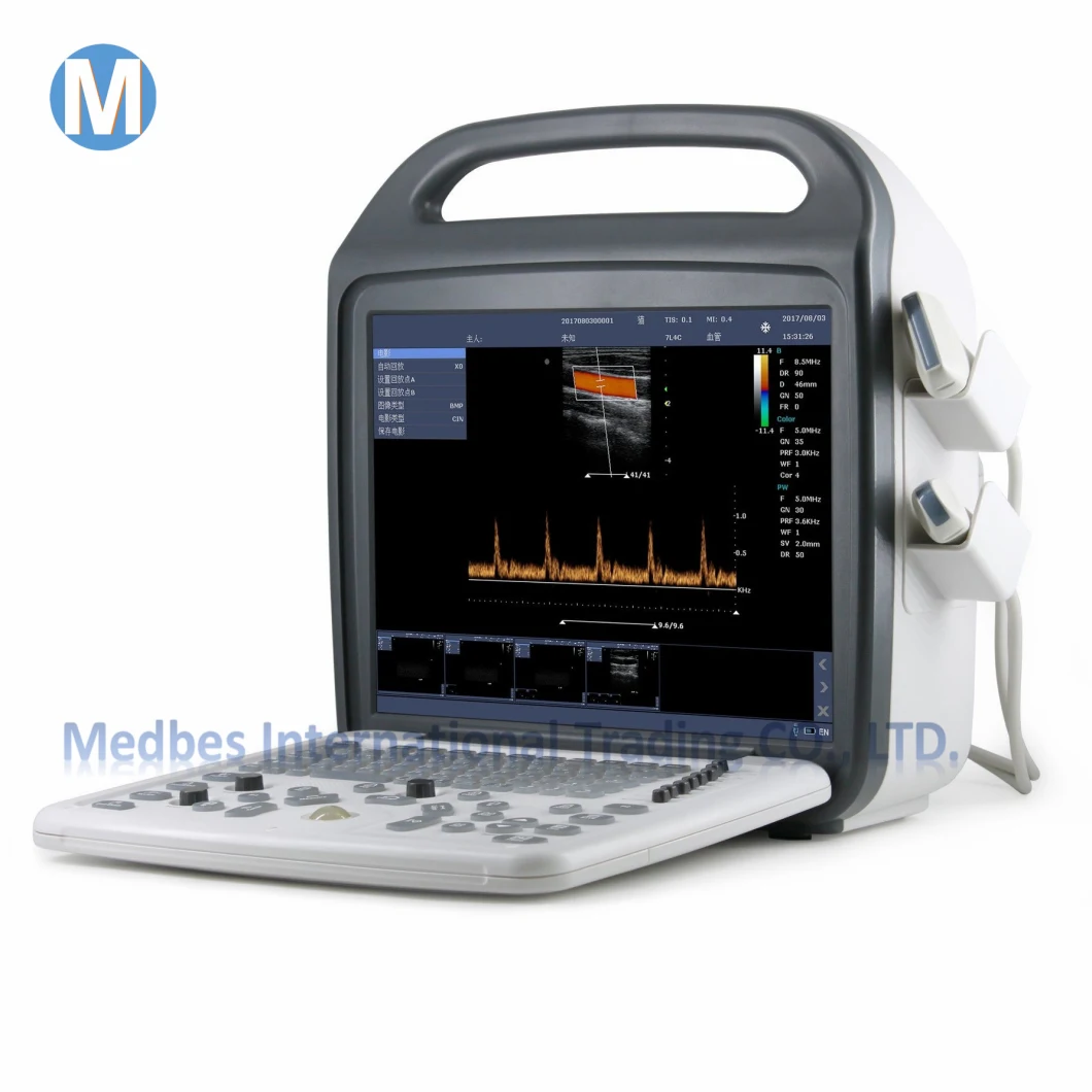 Ophthalmic Equipment Ophthalmic a/B Ultrasound Scanner