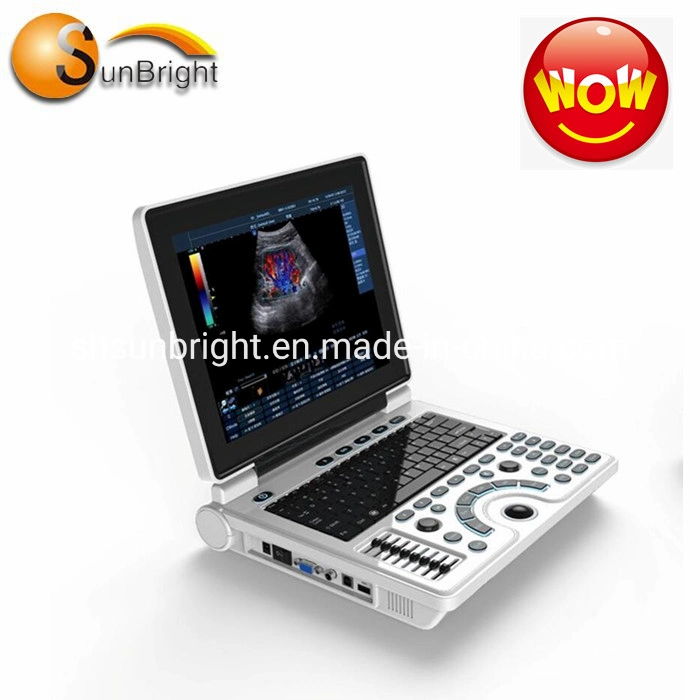 High Quality Popular Selling Portable Ultrasonic Ultrasound Machine Laptop Ultrasound