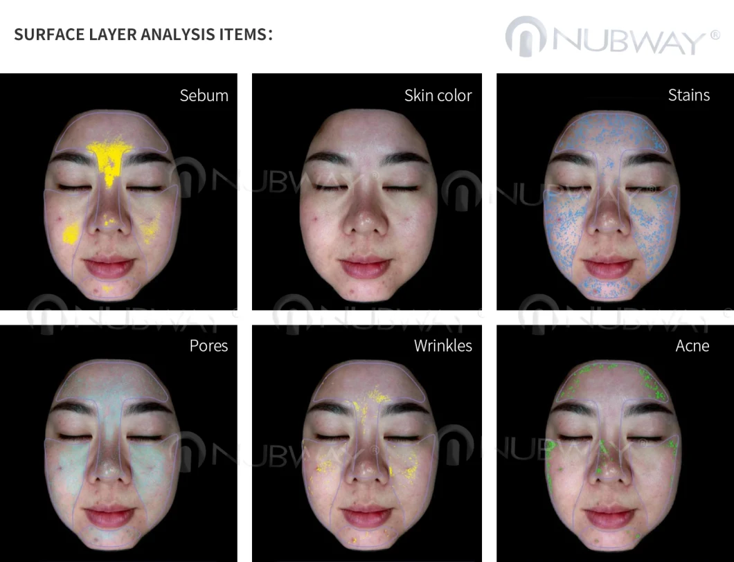 UV Analyzer Skin Lesion Analysis Device Moisture Checker Machine Skin Scanning Machine Special for Skin Analysis