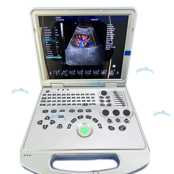 Dawei Ultrasound Diagnostic 4D Portable Ultrasound Scanner Dw-L5 Ecography