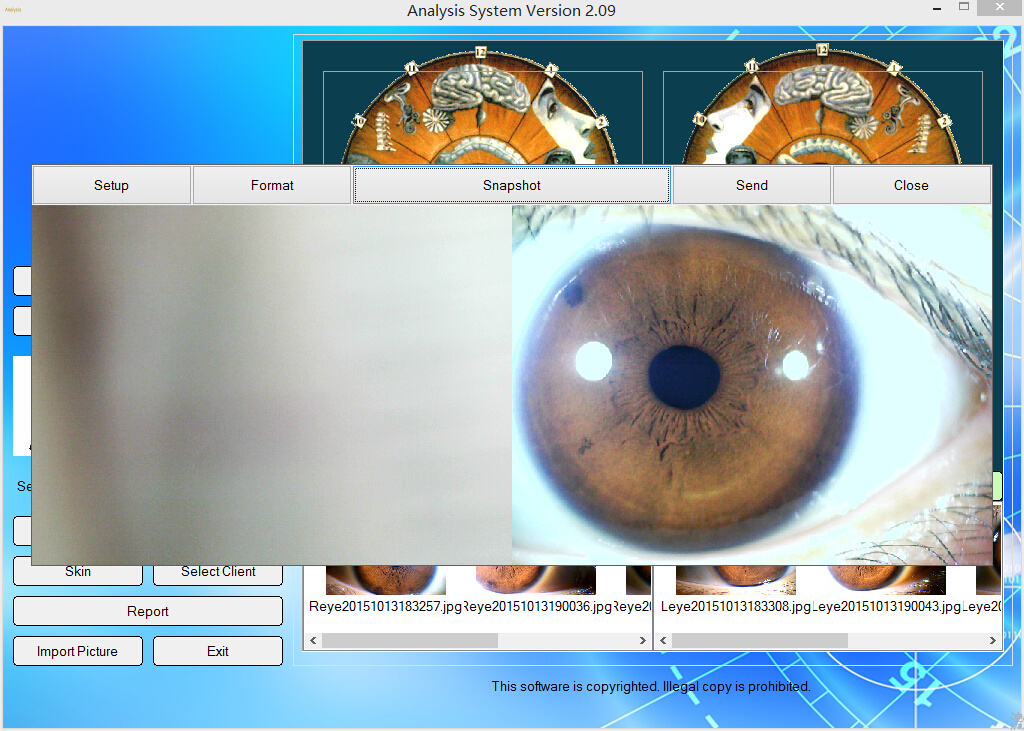 3 in 1 Optional- 5.0MP USB Eye Iriscope Iris Camera + Skin Analyzer + Hair Analyzer