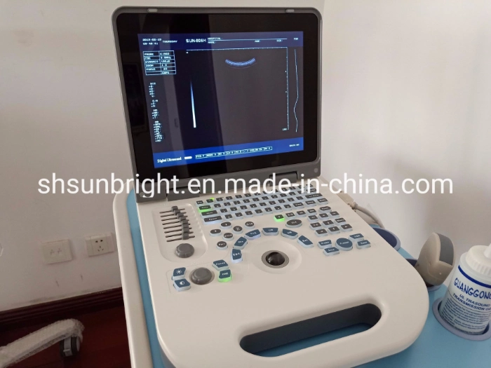 High Quality Ultrasound Competitive Price 2 Probe Ports