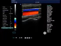 China Suppliers Cardiac Ultrasound Machine Trolley Color Doppler Ultrasound Scanner