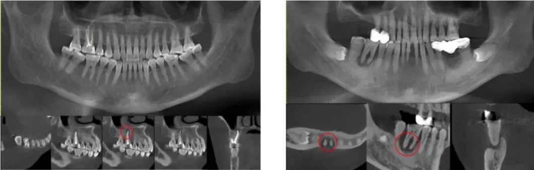 Hires 3D-Plus CE Professional Large Fov Dental 3D Cone Beam Computred Tomography Cbct