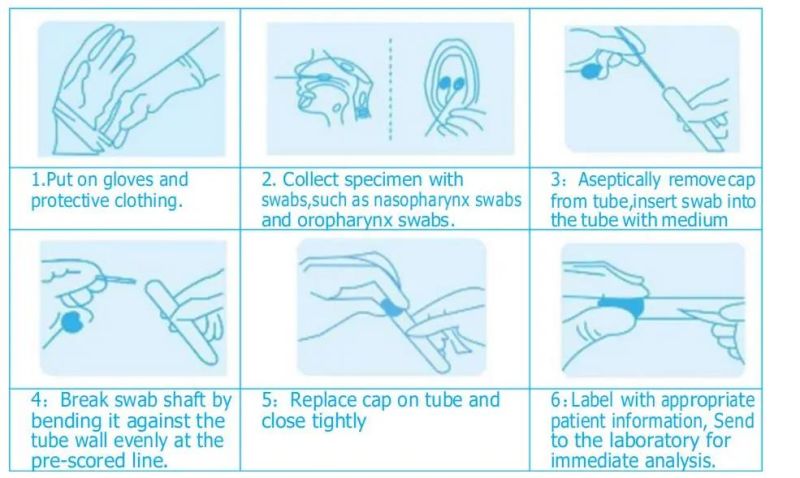 Individual Bag Package Virus Transport Tube with Vtm Sampling Swab Kits