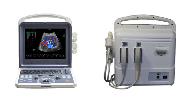 4D Color Digital Notebook Ultrasound System Scanner YJ-U60
