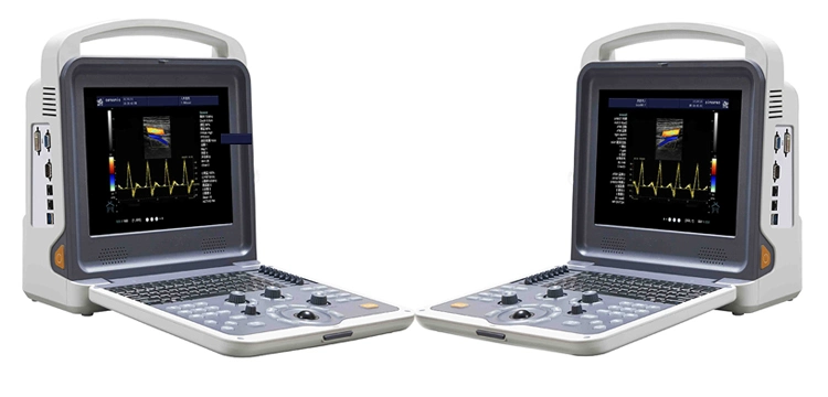 Yj-U60 Diagnostic System Full Digital Color Doppler Ultrasound Scanner