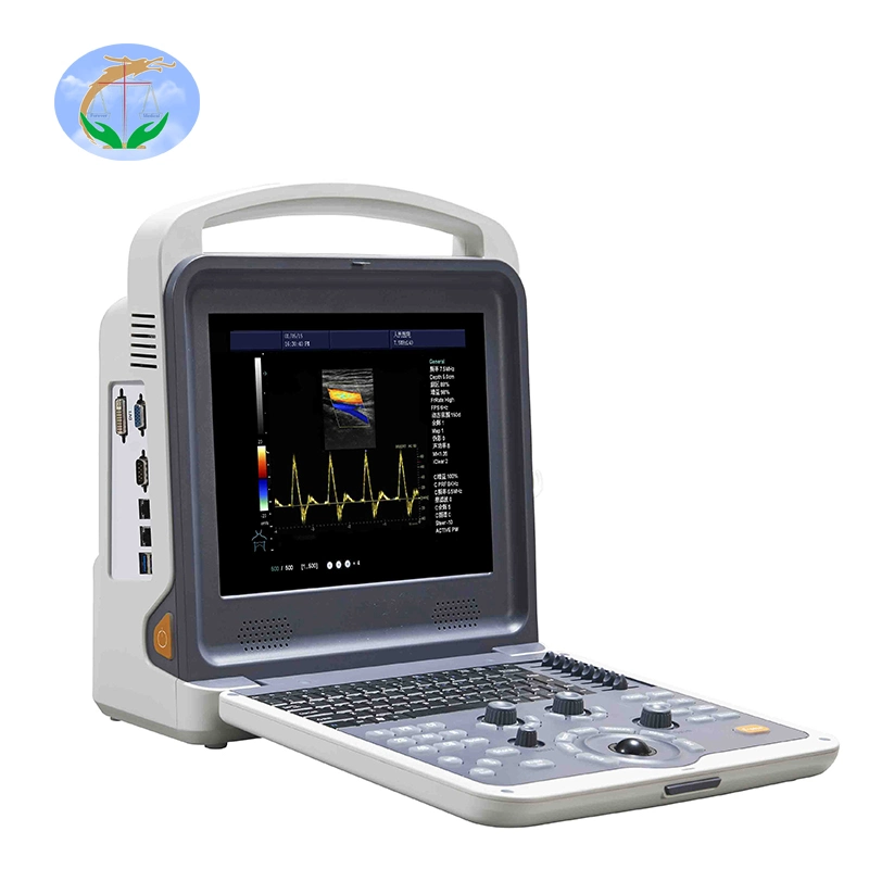 Ce Approved 12 Inch Medical Diagnosis System Full Digital Portable Ultrasound Scanner (YJ-U60)