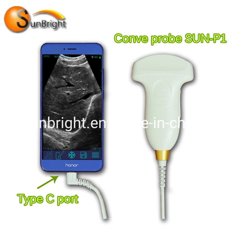 USB Ultrasound Convex Probe Sun-P1 Cheap Portable Ultrasound Probe